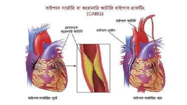 কোয়ান্টাম ইয়োগা করুন? নিয়মিত হাঁটুন